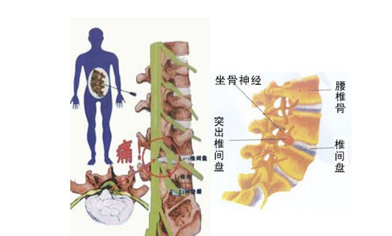 骨质增生科